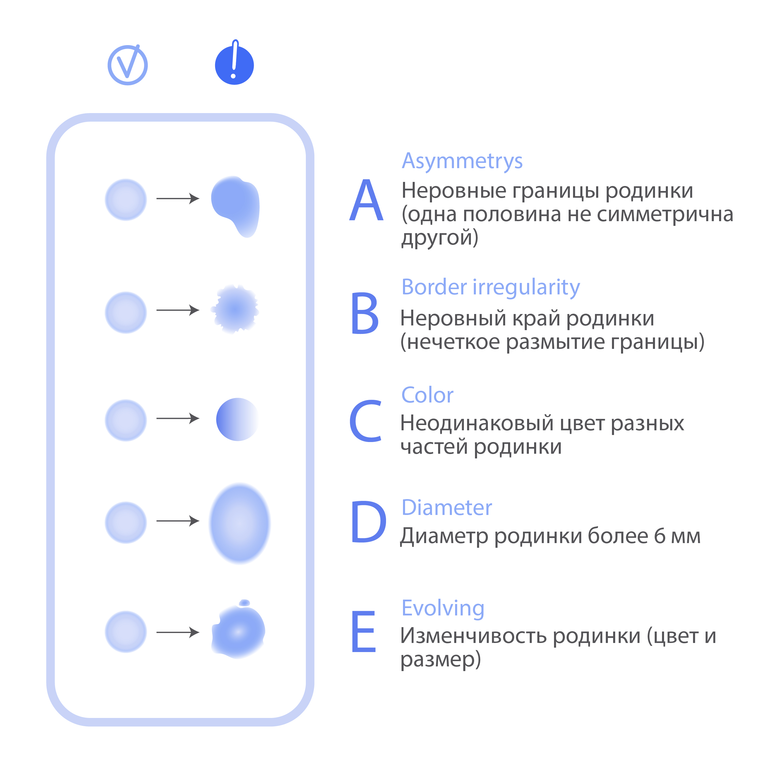 Как выглядит меланома?