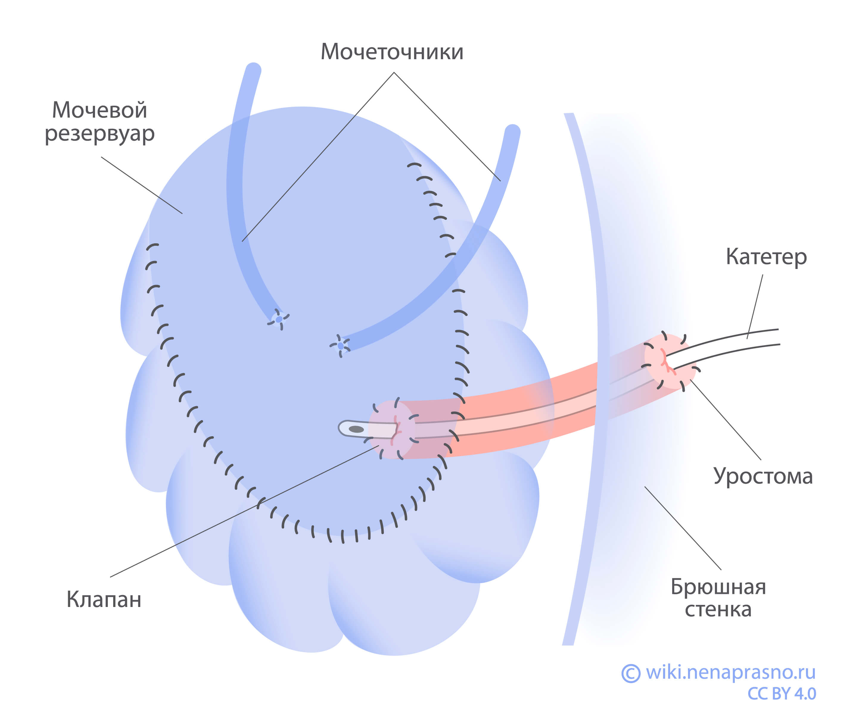 Мочевой_резервуар.jpg