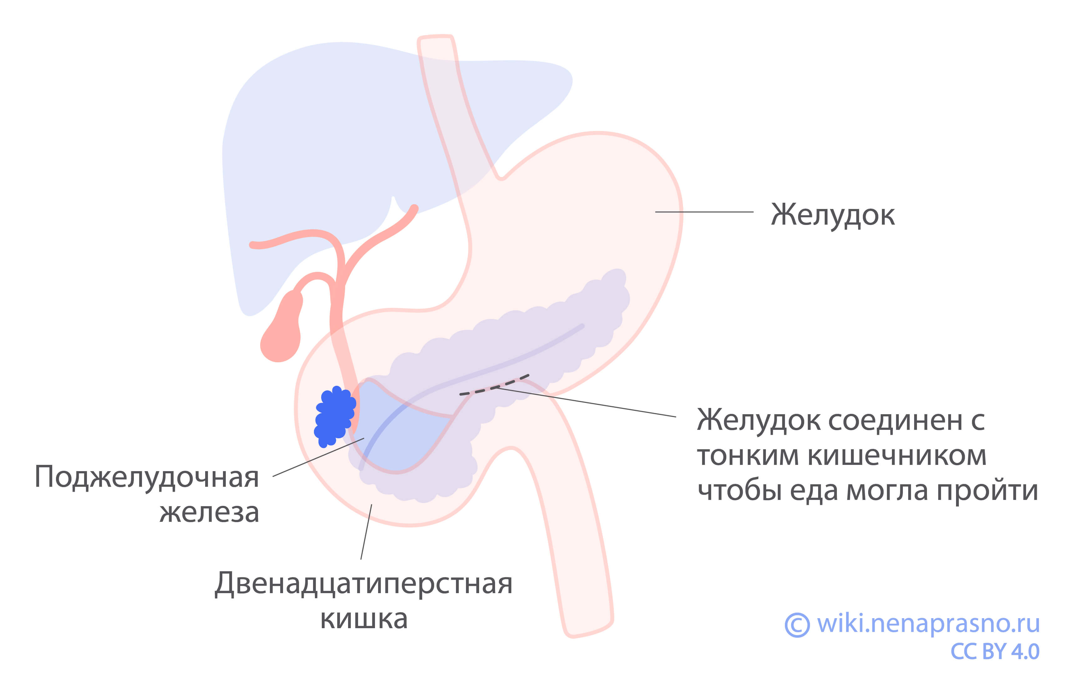 Хирургия в паллиативных целях при раке поджелудочной железы