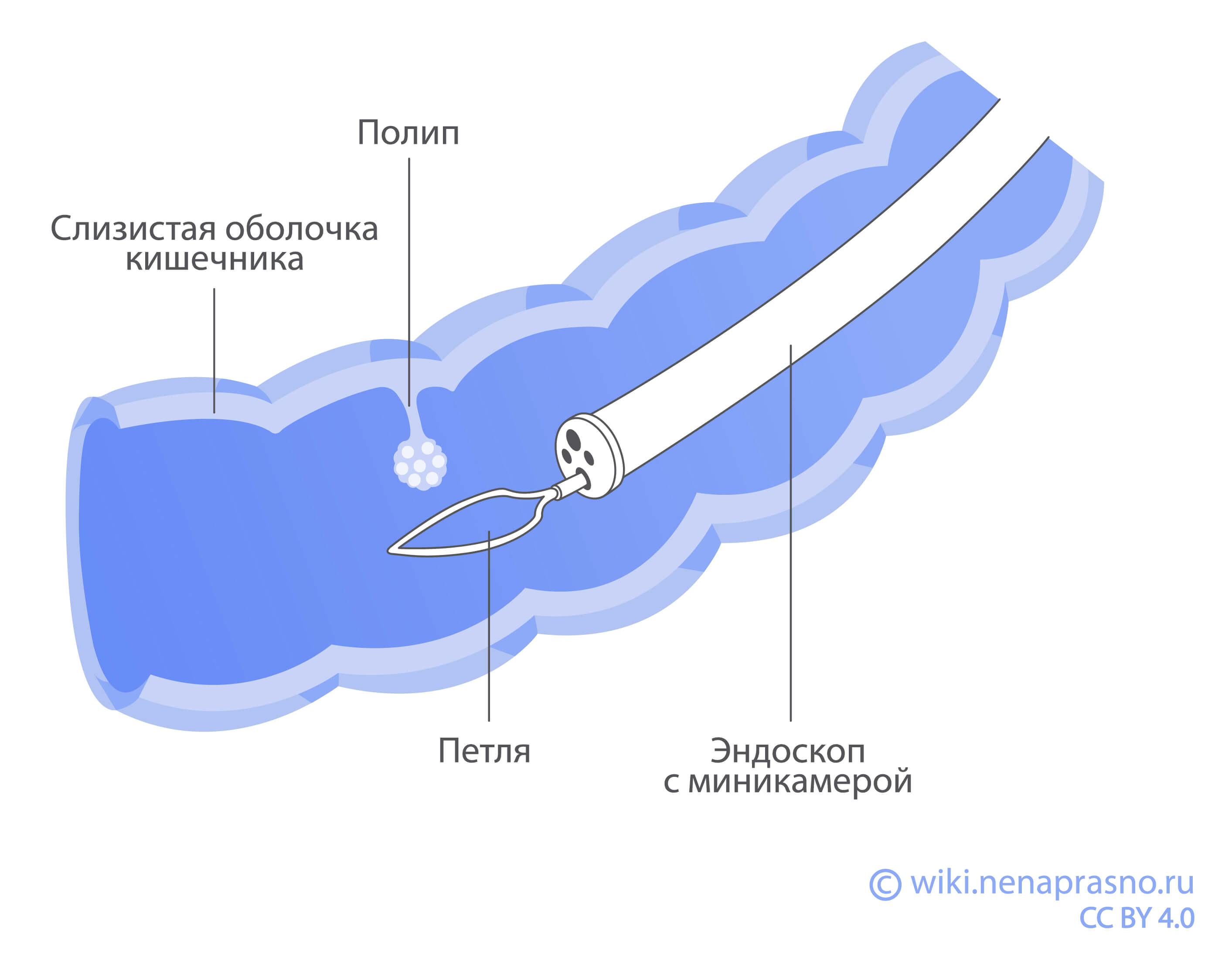 Хирургическое лечение рака: каким бывает и кому показано?