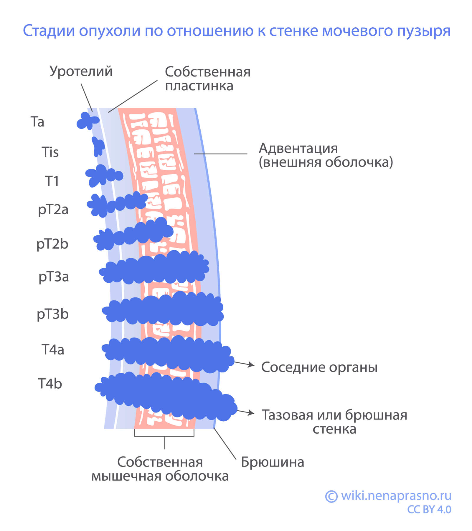 Стадии_стенка_мочевого_пузыря.jpg