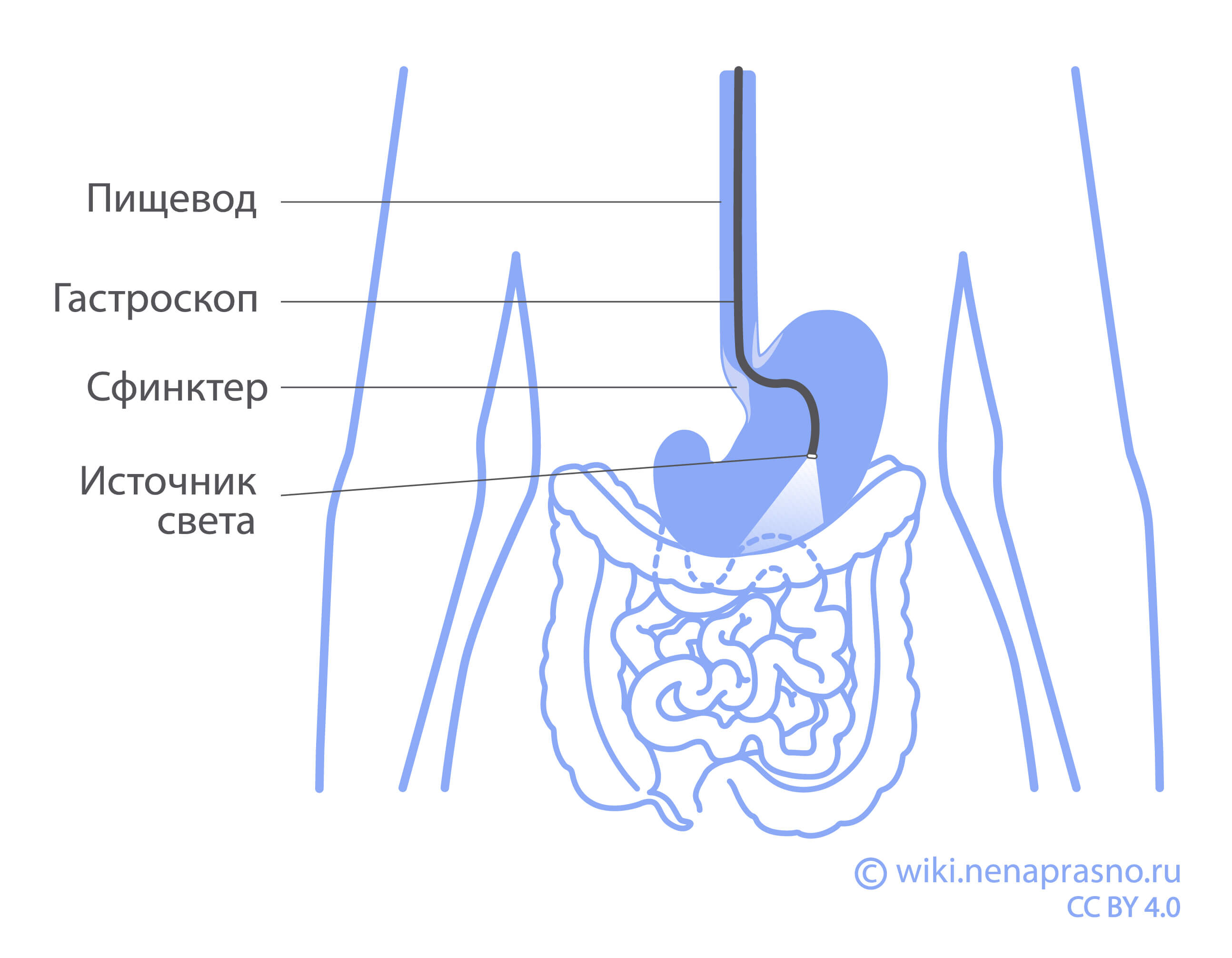 Гастроскопия и биопсия при подозрении на рак пищевода.jpeg