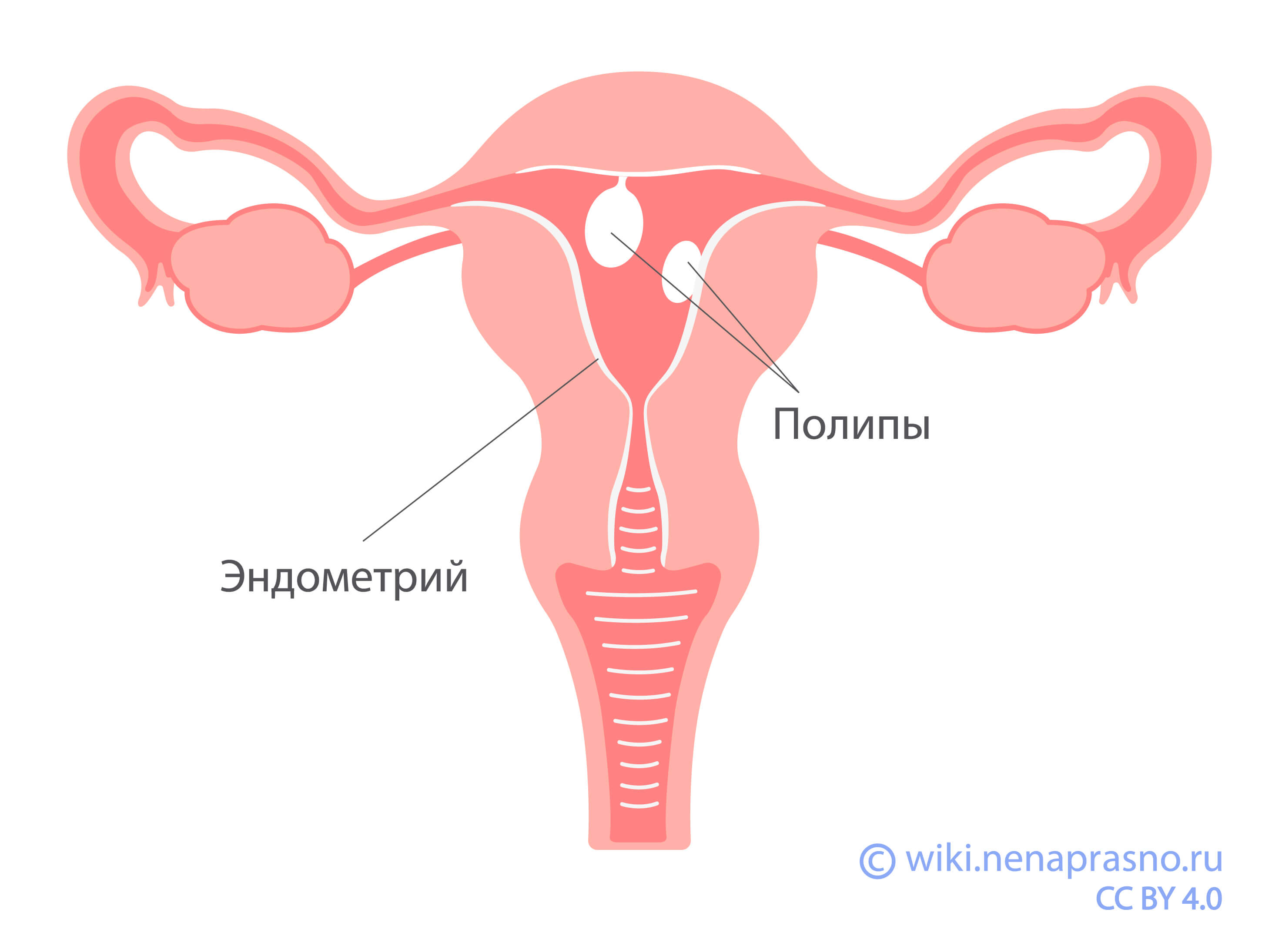 удаление матки и яичников и оргазм фото 10