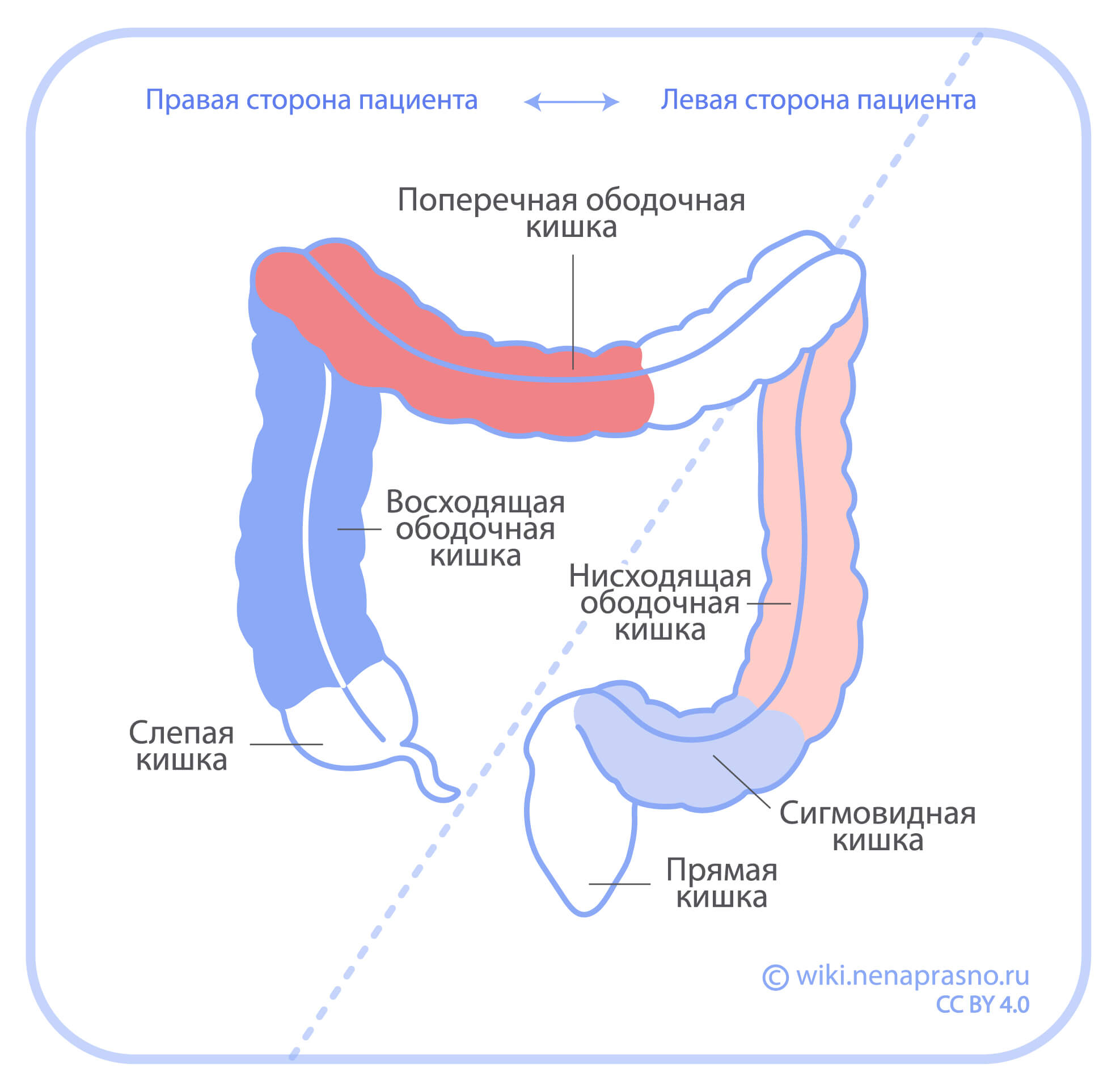 Признаки наличия опухоли сигмовидной кишки, методы лечения - блог Виртус