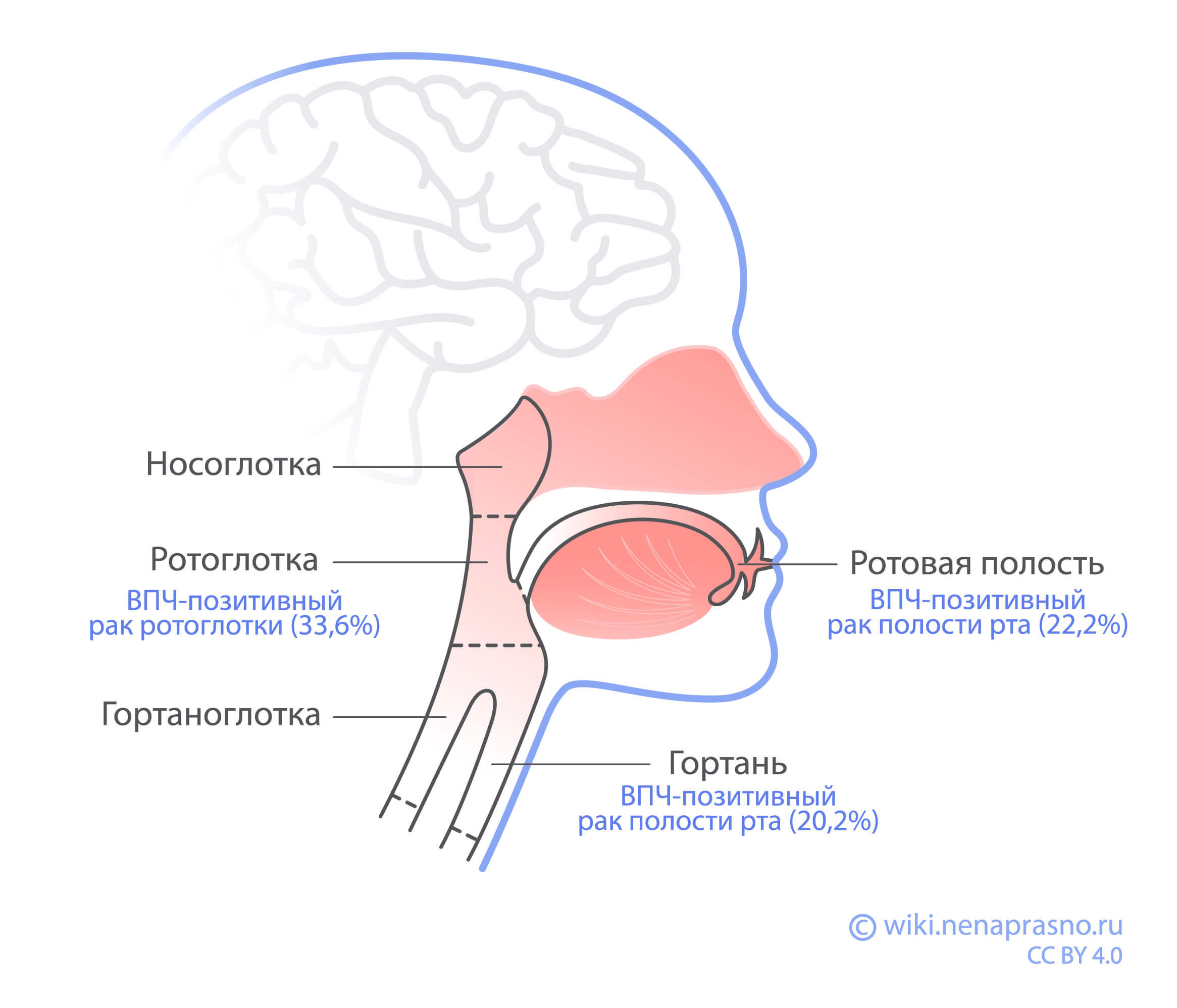 Опухоли головы и шеи и ВПЧ.jpg