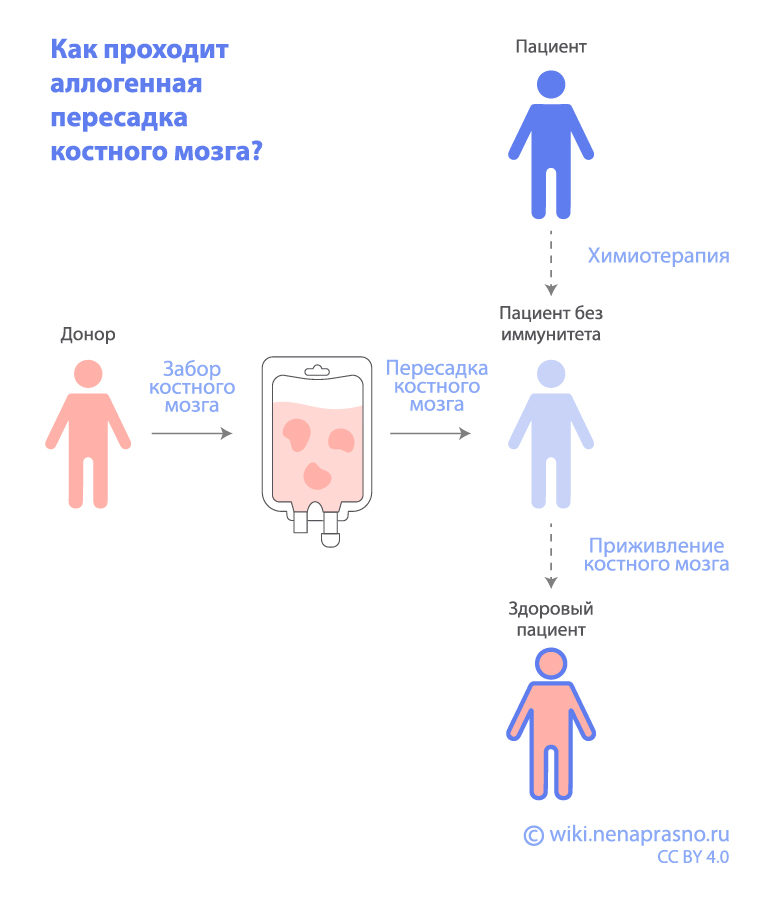 Трансплантация гемопоэтических стволовых клеток при ОМЛ