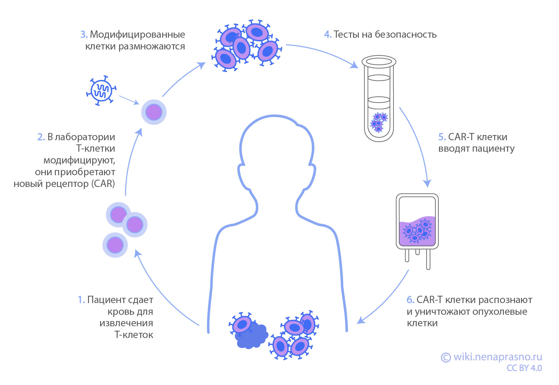 CAR-T и другие виды клеточной терапии при ОЛЛ