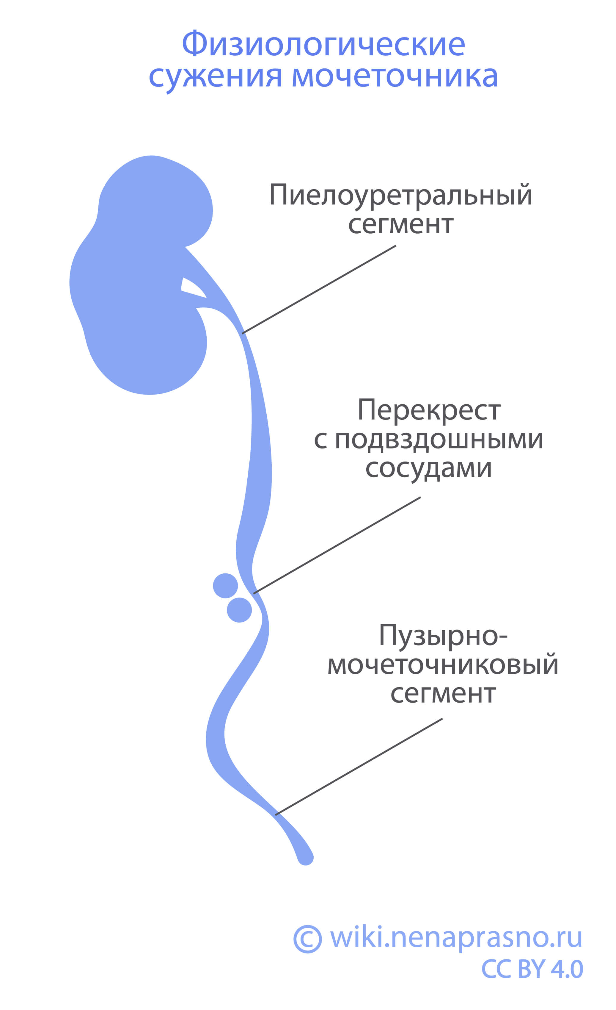 Физиологические сужения мочеточника.jpg