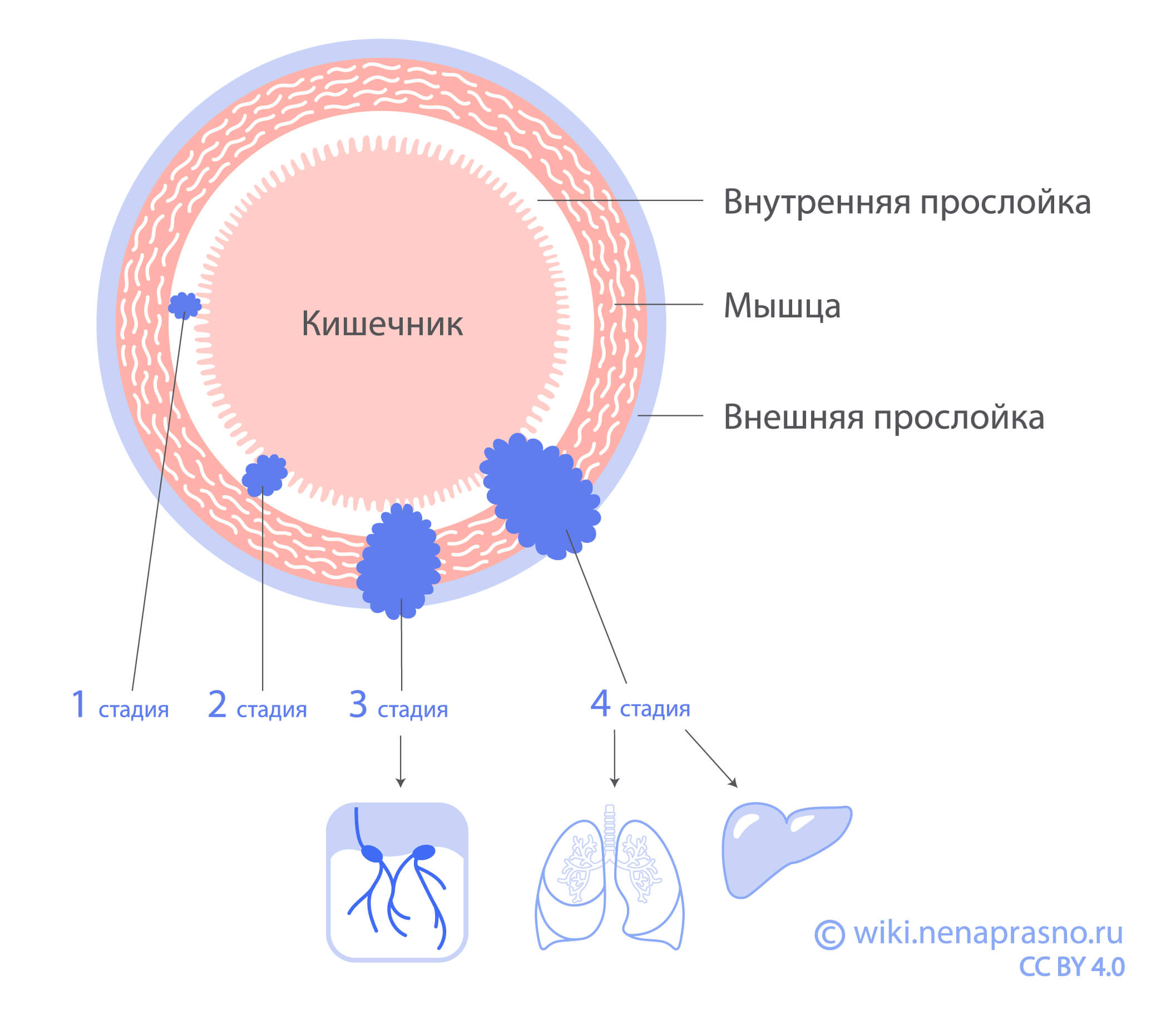 Лечение лимфоузлов (лимфаденита) в Киеве: цены и отзывы в Оксфорд Медикал