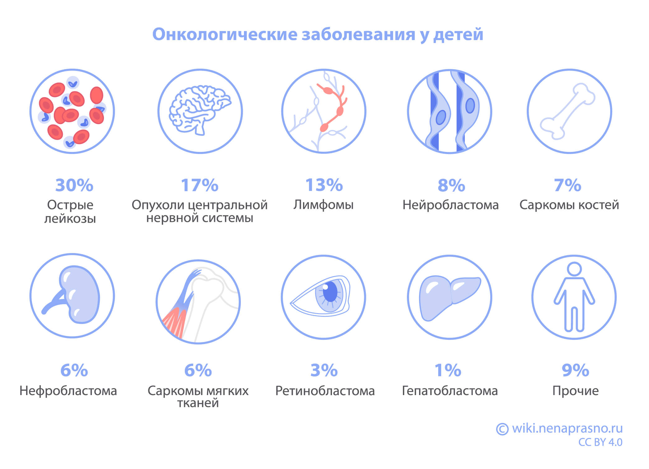 Какие опухоли встречаются у детей?