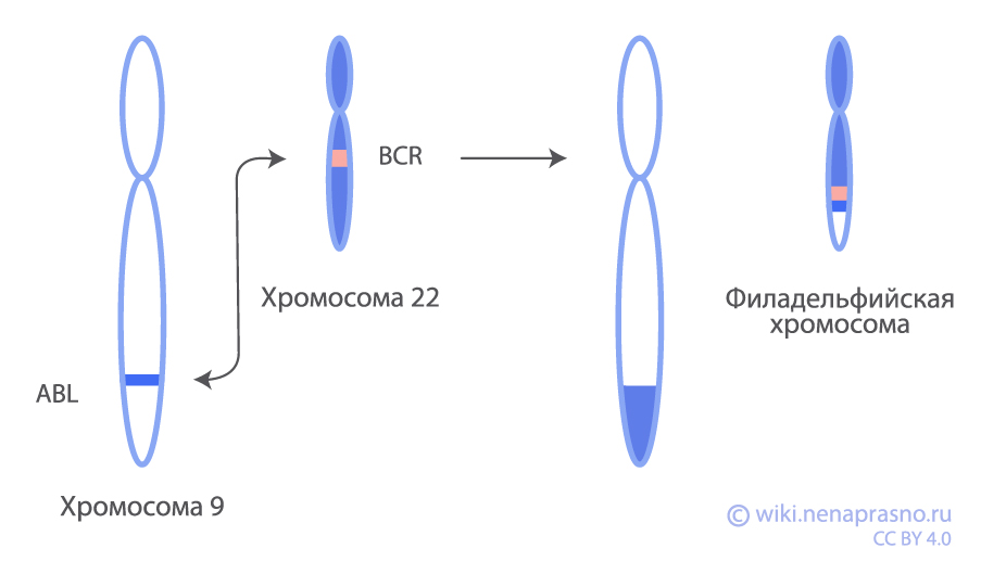 Ph+ и Ph-like ОЛЛ