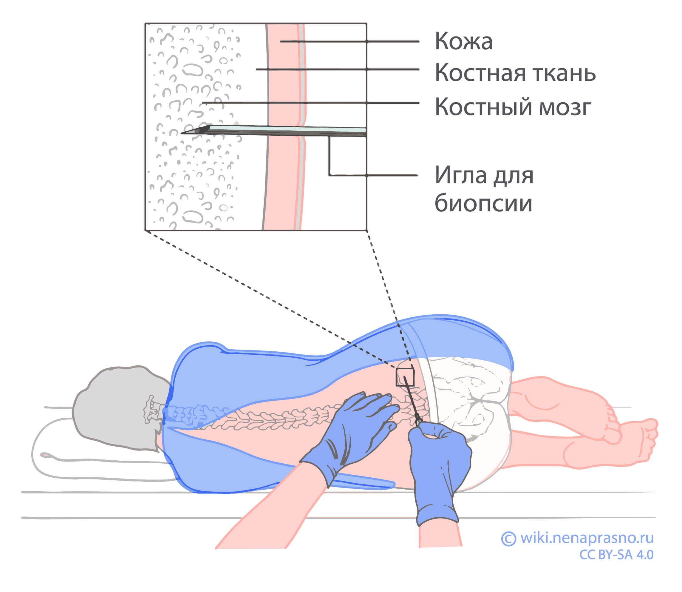 Исследования костного мозга и спинномозговой жидкости