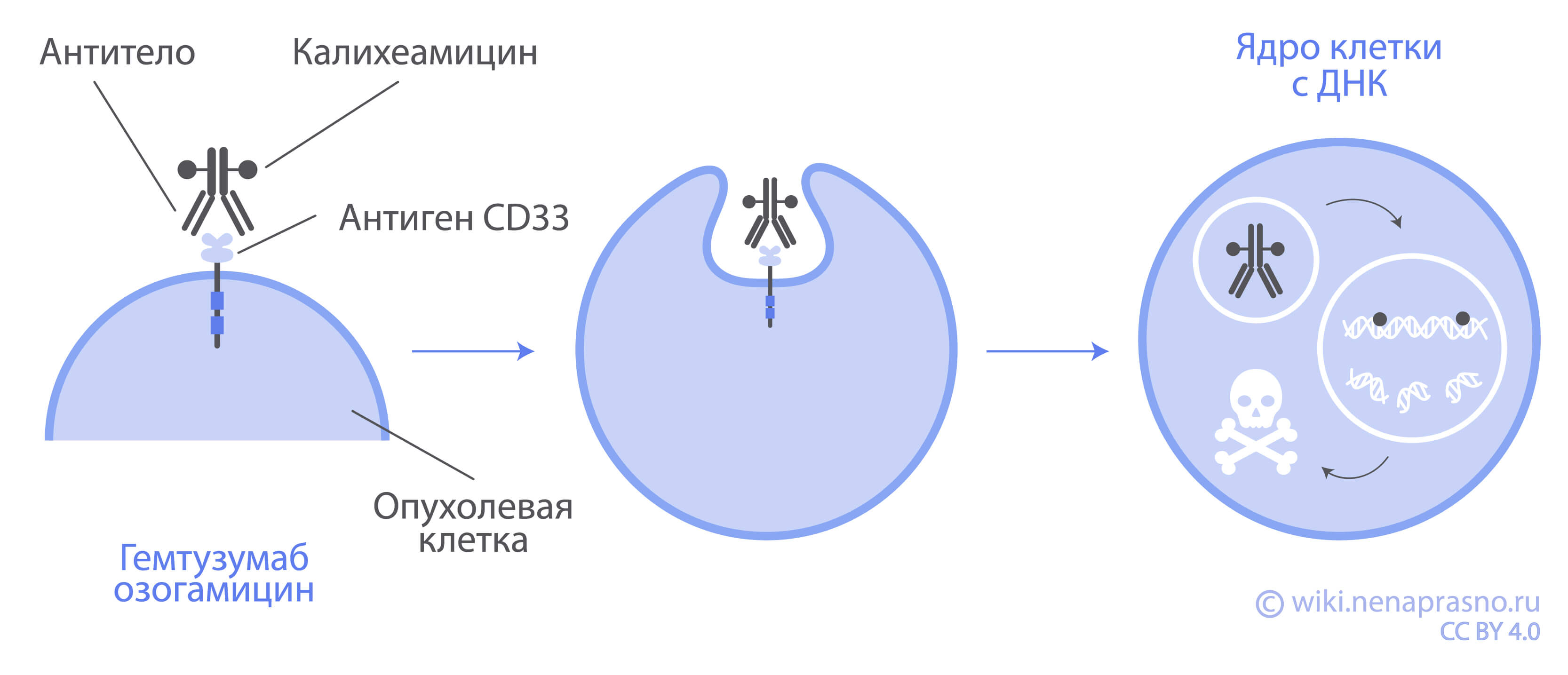 Острый лейкоз из ранних Т-клеточных предшественников (ETP-ОЛЛ)